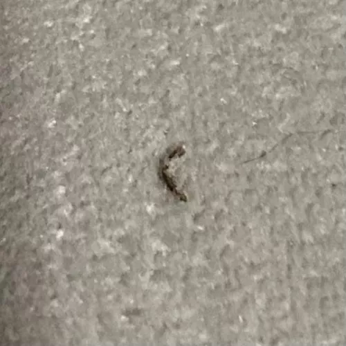 [PIC] i had this annoying thing in my leg for weeks until I decided to try popping it. Sorry for no video