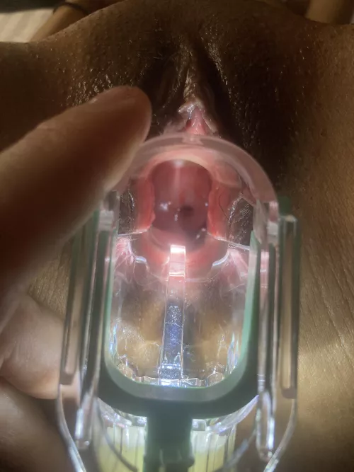 Speculum spreading girlfriends hole.