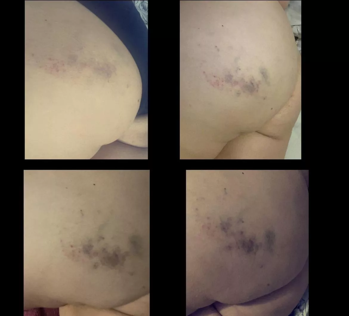 Getting better everyday. Thank you for my beating Daddy