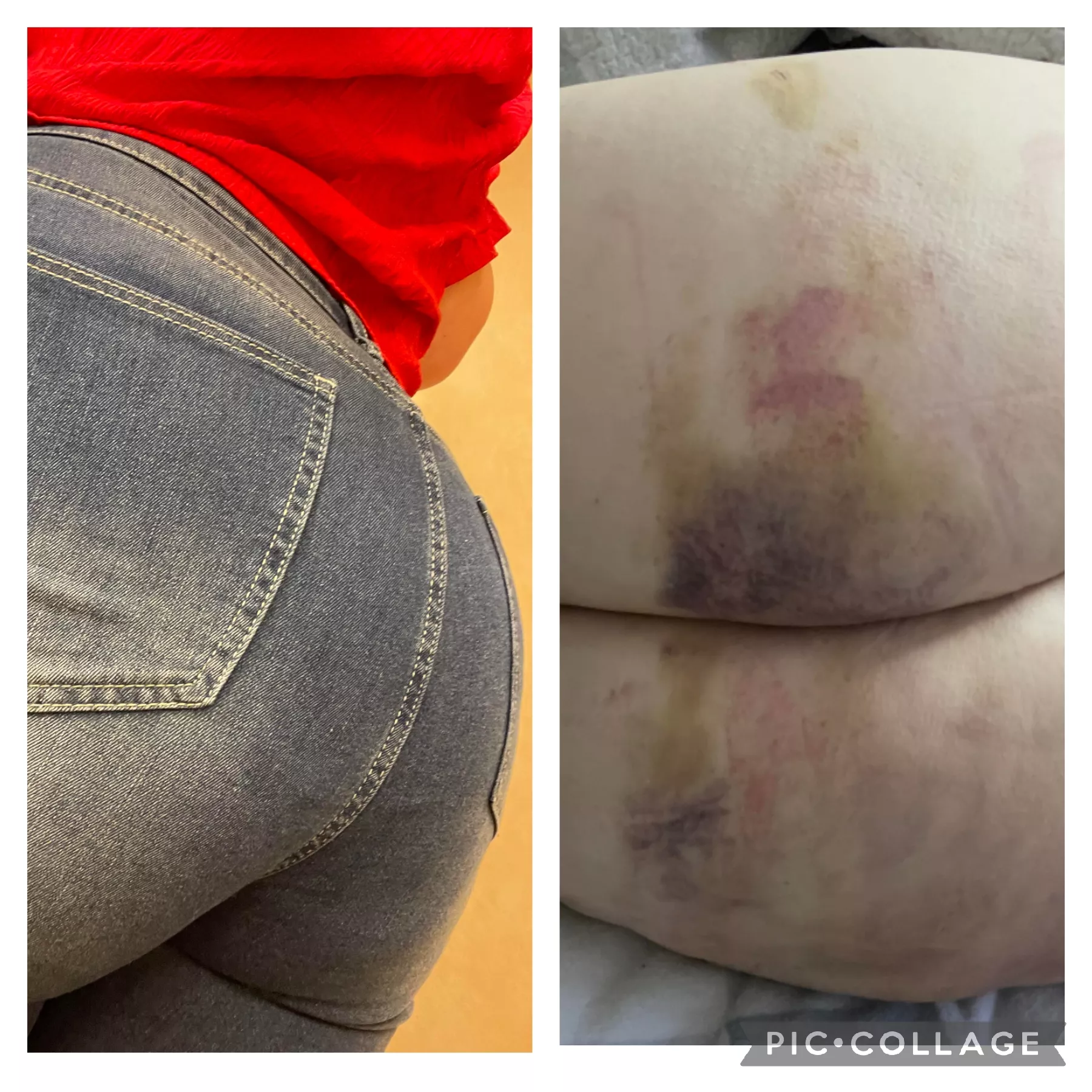 She Loves to be Marked. Besides the Strap - What Else Can We Use? Suggestions Wanted!