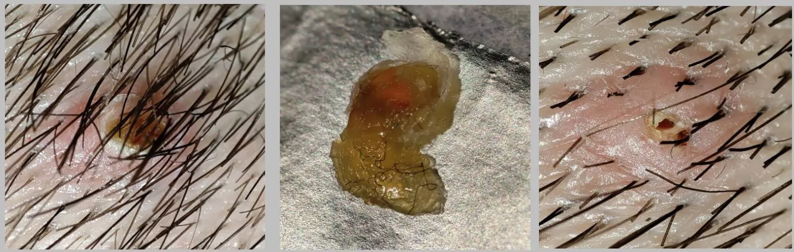 Most satisfying in my life. Just pulled whole thing out.