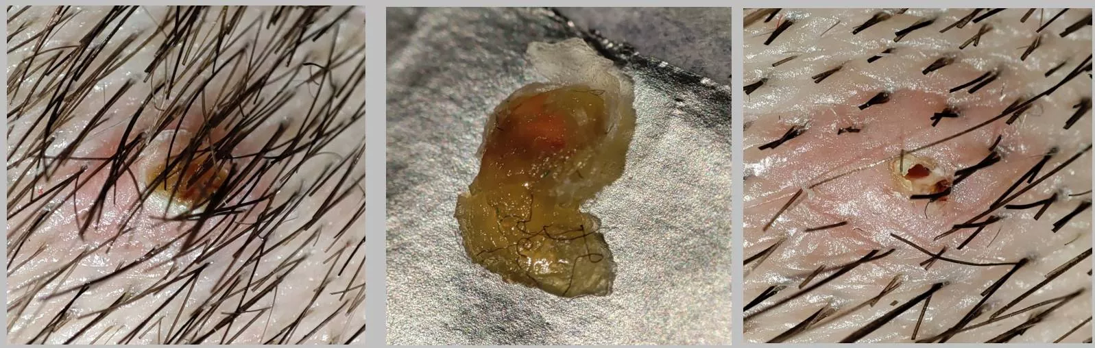 Most satisfying in my life. Just pulled whole thing out.