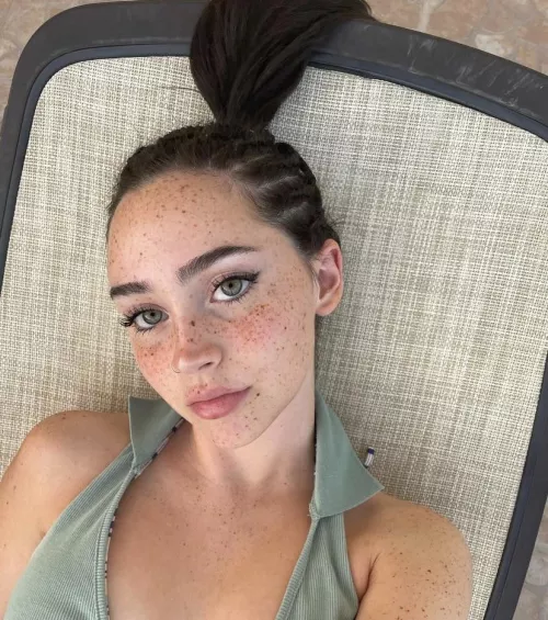 Beautiful freckles