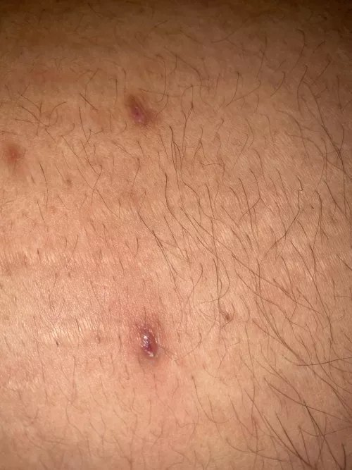 What do these look like to u