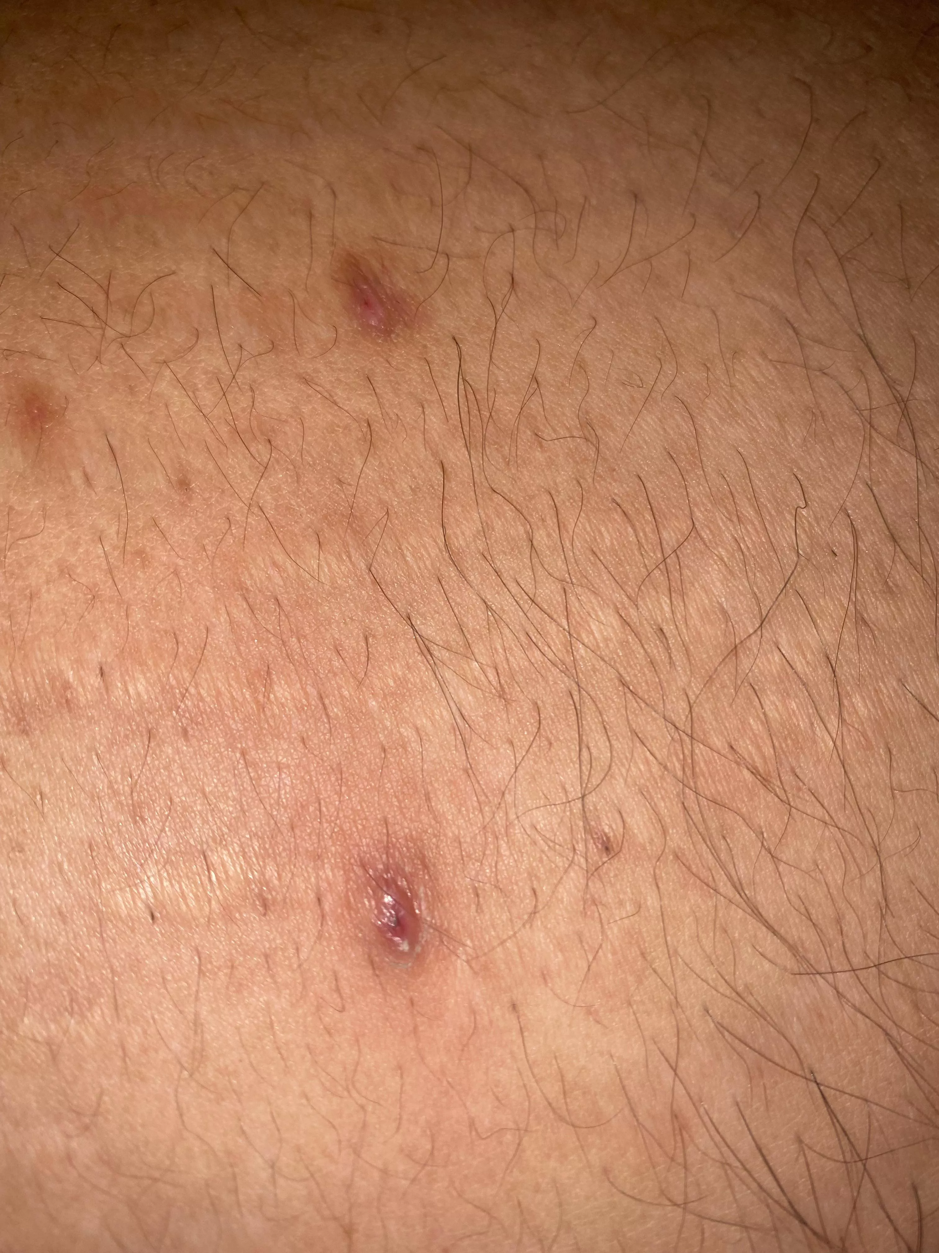 What do these look like to u