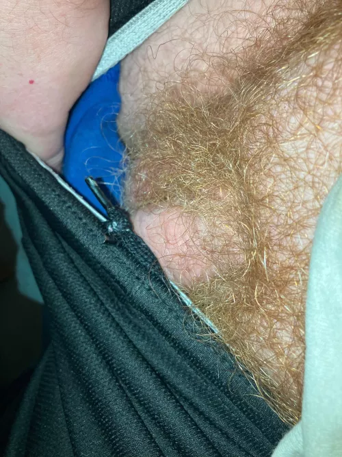 Anyone else have ginger pubes ?