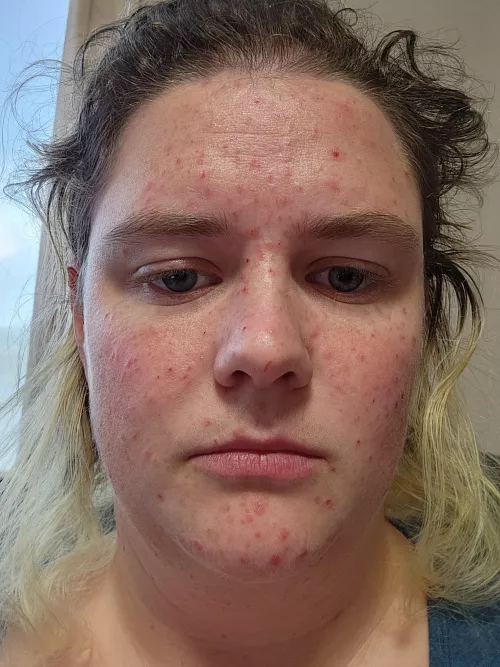 Terrified of posting this but I believe awareness is the key to support and change.