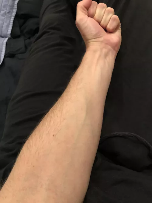 I feel weak on my forearm