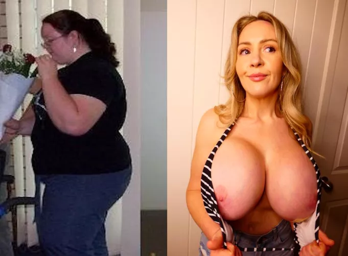 My before and after! Still healing a bit on my 4th boob job here guys!