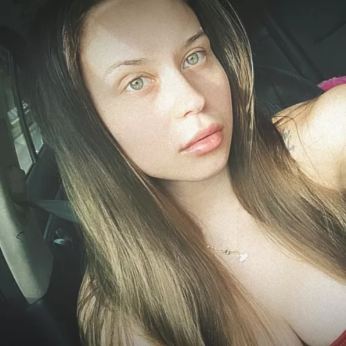 Unfortunately, she got a lip filler