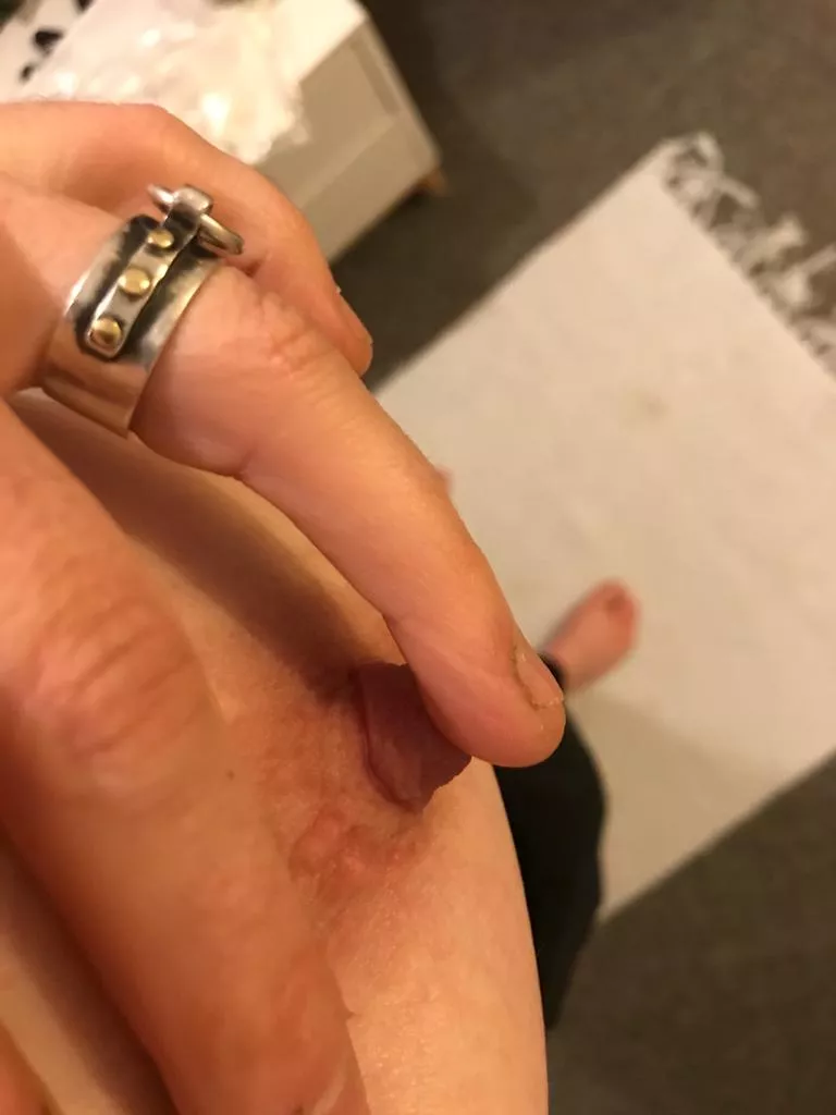 Showing me where she requires my teeth.