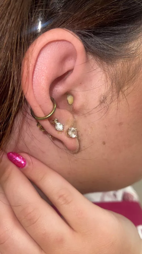 Ear infection! So painful