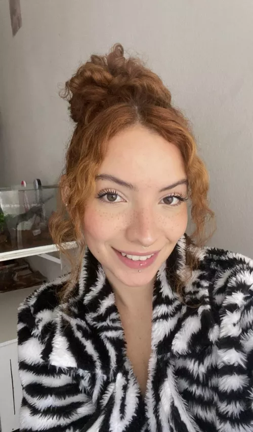 Is it true that freckles and red hair is a deadly combo