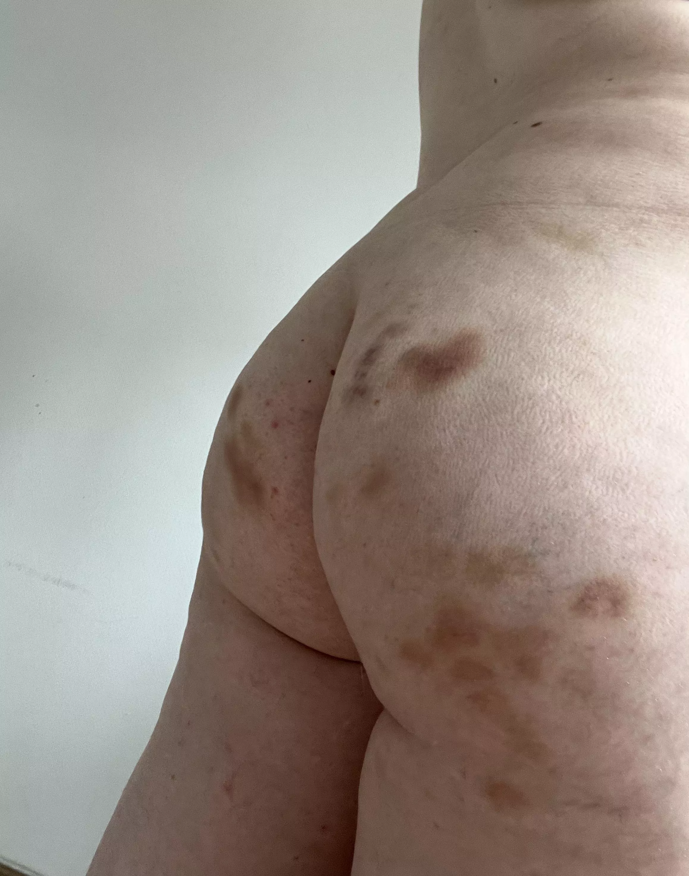 My ass after a weekend with my boyfriend