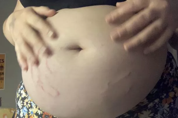 before the bloat got too big and had to be stuffed into that latex coat…