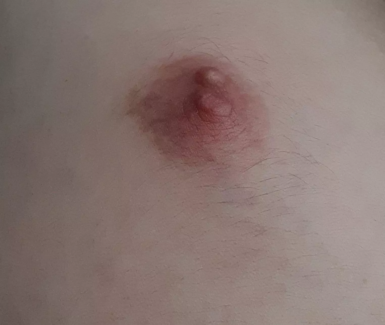 Can anybody tell me what that lump is above my nipple?