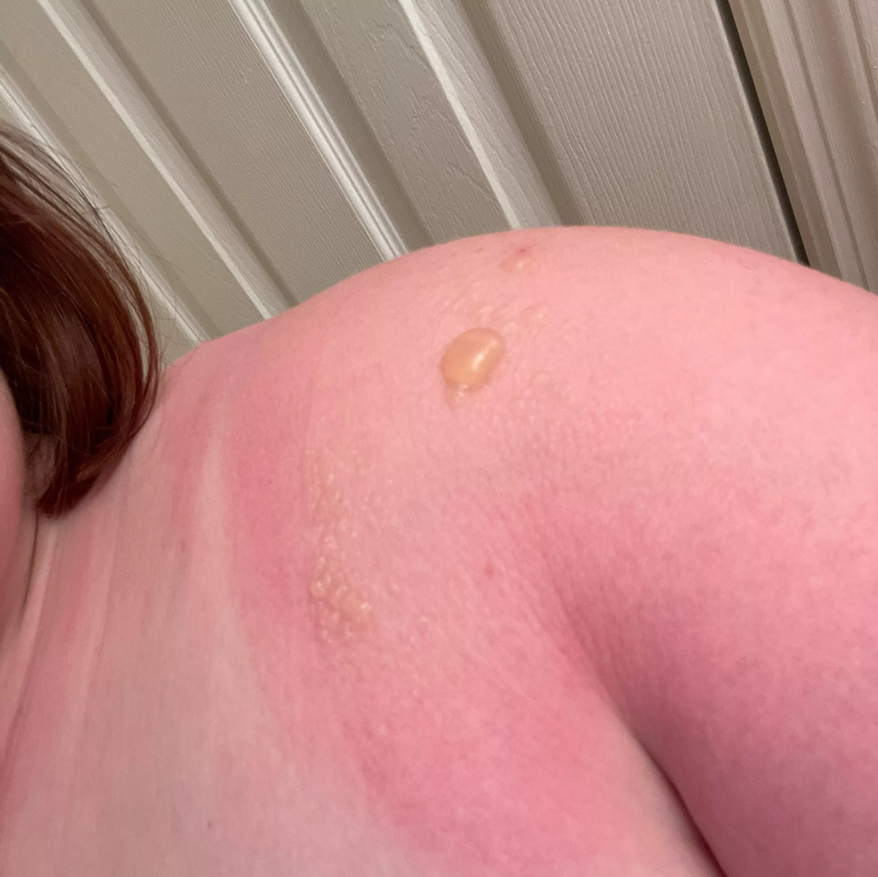 Forbidden shoulder pops (souvenirs from TWICE concert)