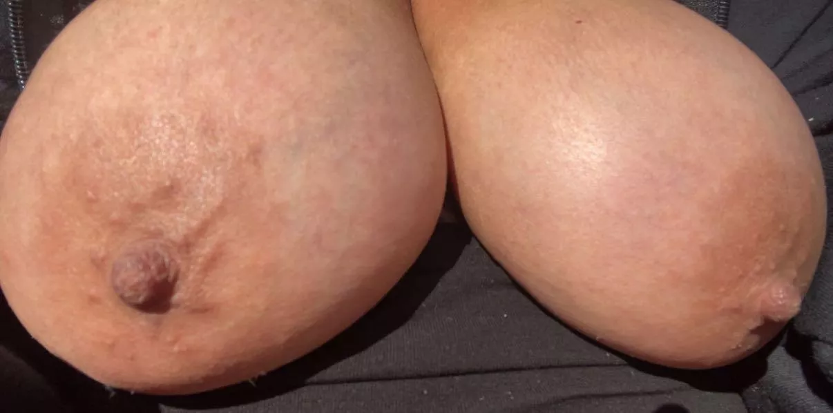 My saggy udder out in Sun - would you please Them?