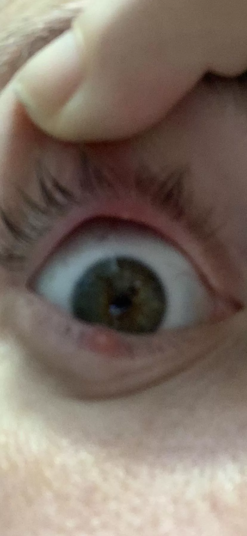 The urge to pop is unreal.