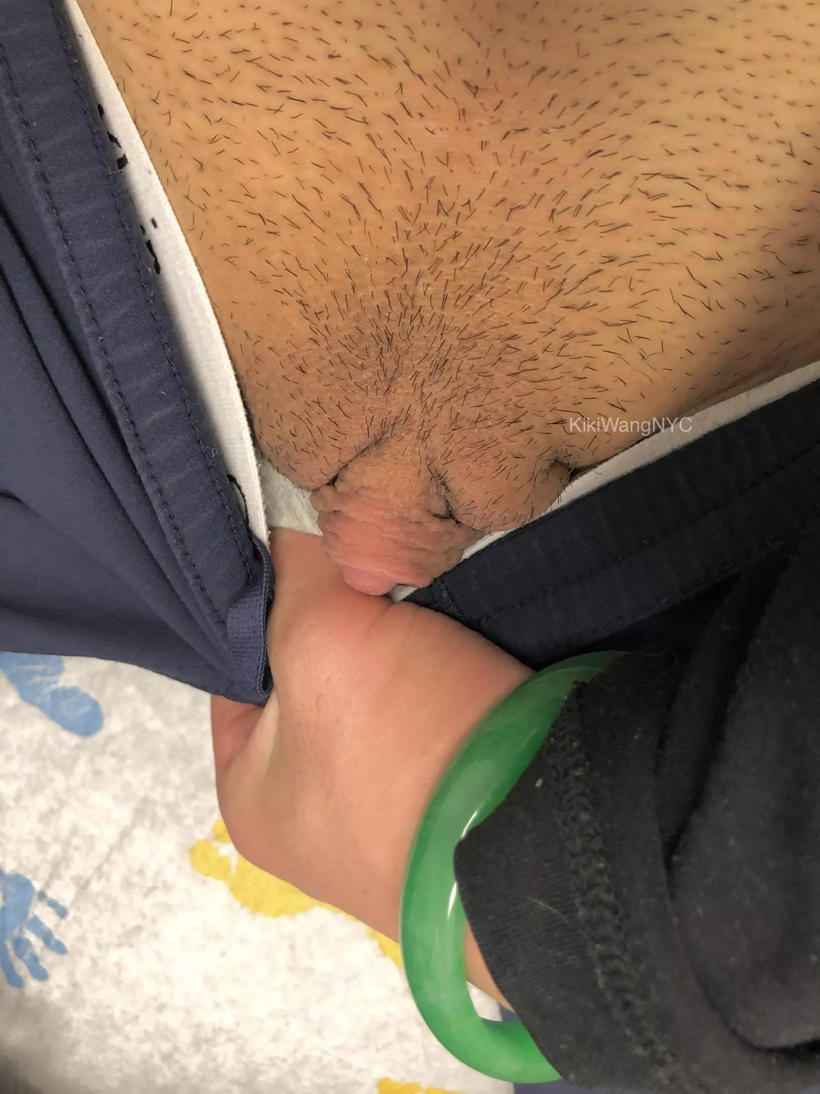 I hope the urgent care staff don’t mind… 😮‍💨