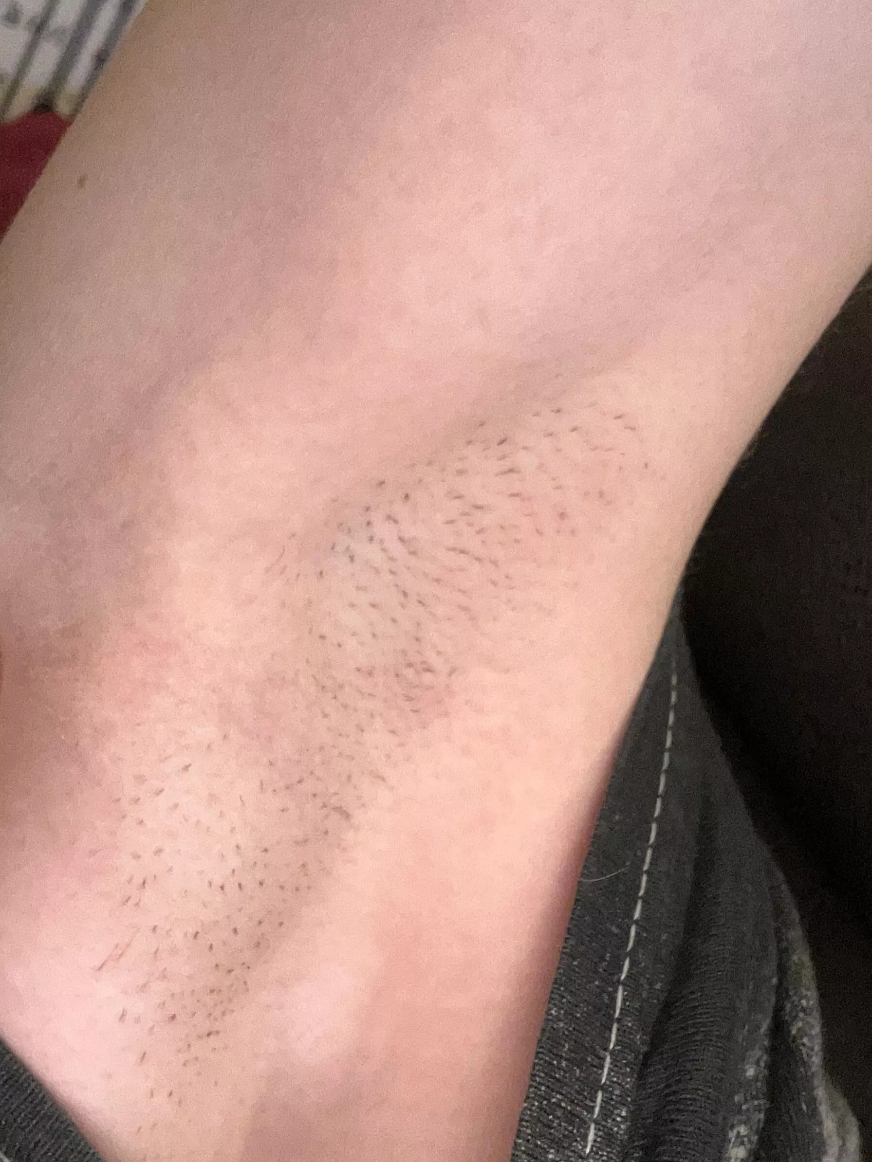 Would you lick them?