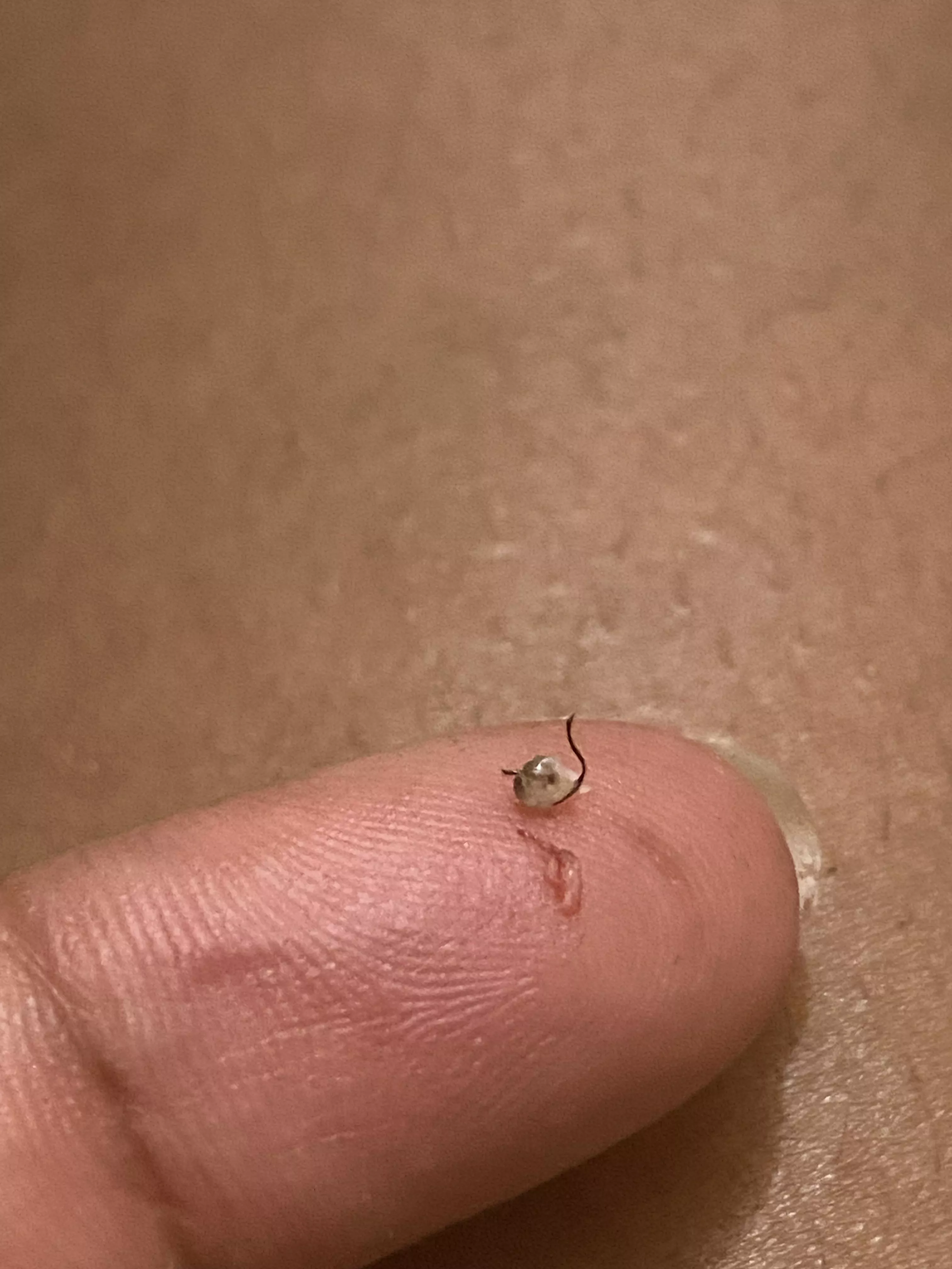 Unexpected pubic pop result