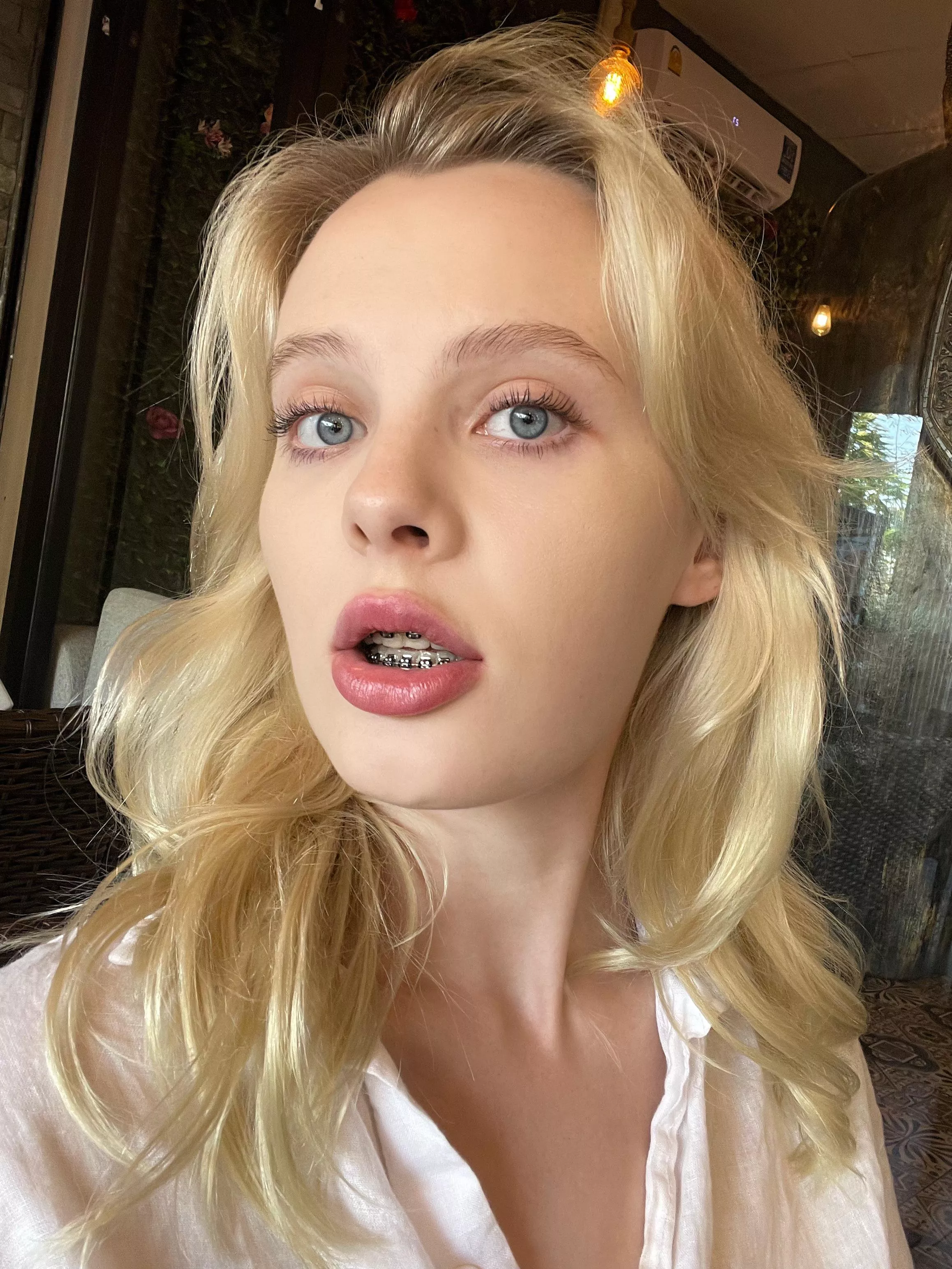 ok then here's my braces!