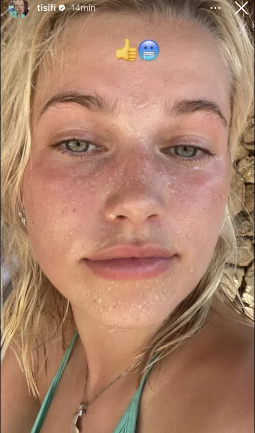 Skade from Last Kingston