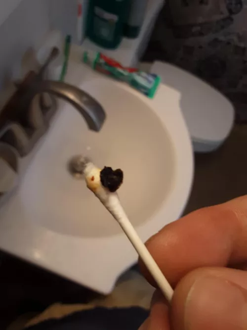 Was cleaning my ear and felt something fall out...