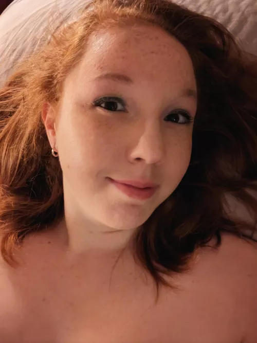 Care to find every freckle