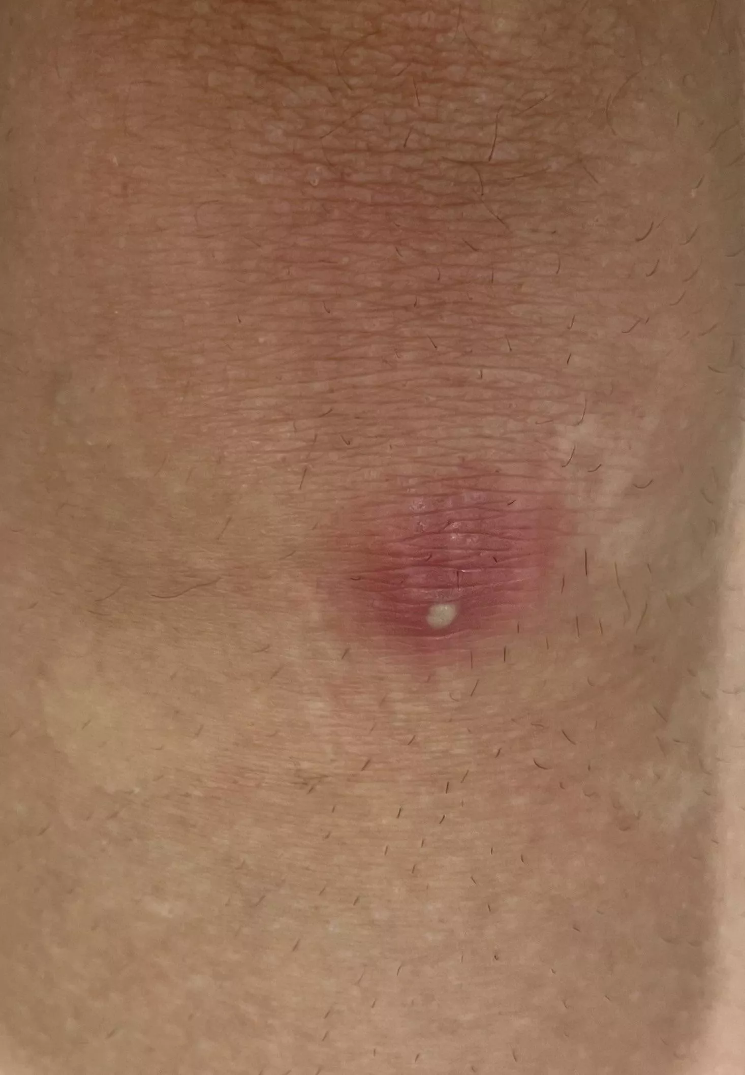 please enjoy my forbidden knee pop