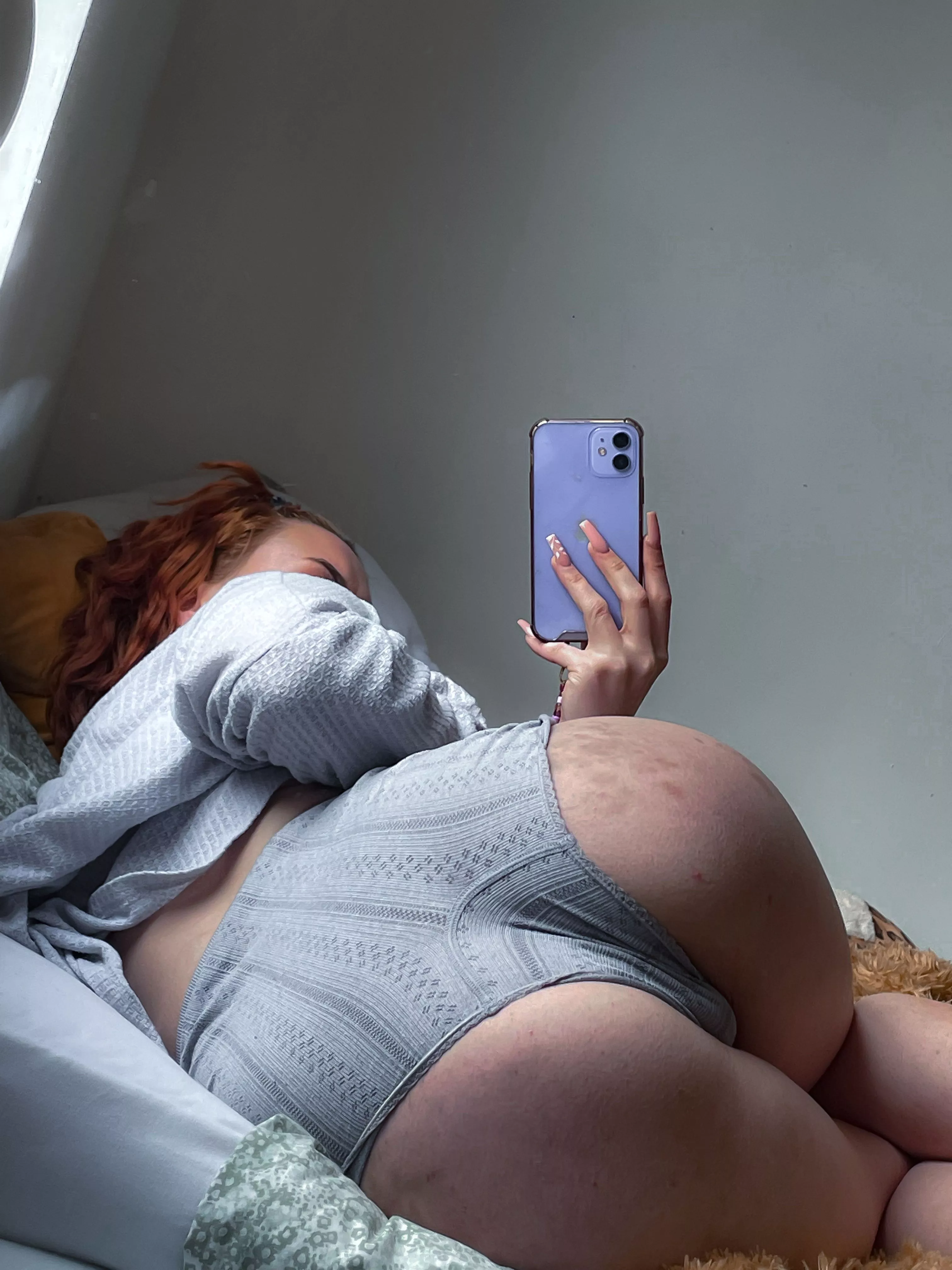 Do I need more bruises...? xx