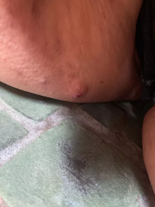 Bad boy brewing between my thighs in the FL heat. Will pop tonight if it doesn’t do it on it’s own