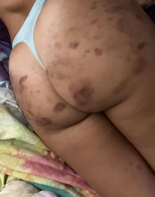 I asked for a break and he said no [f]