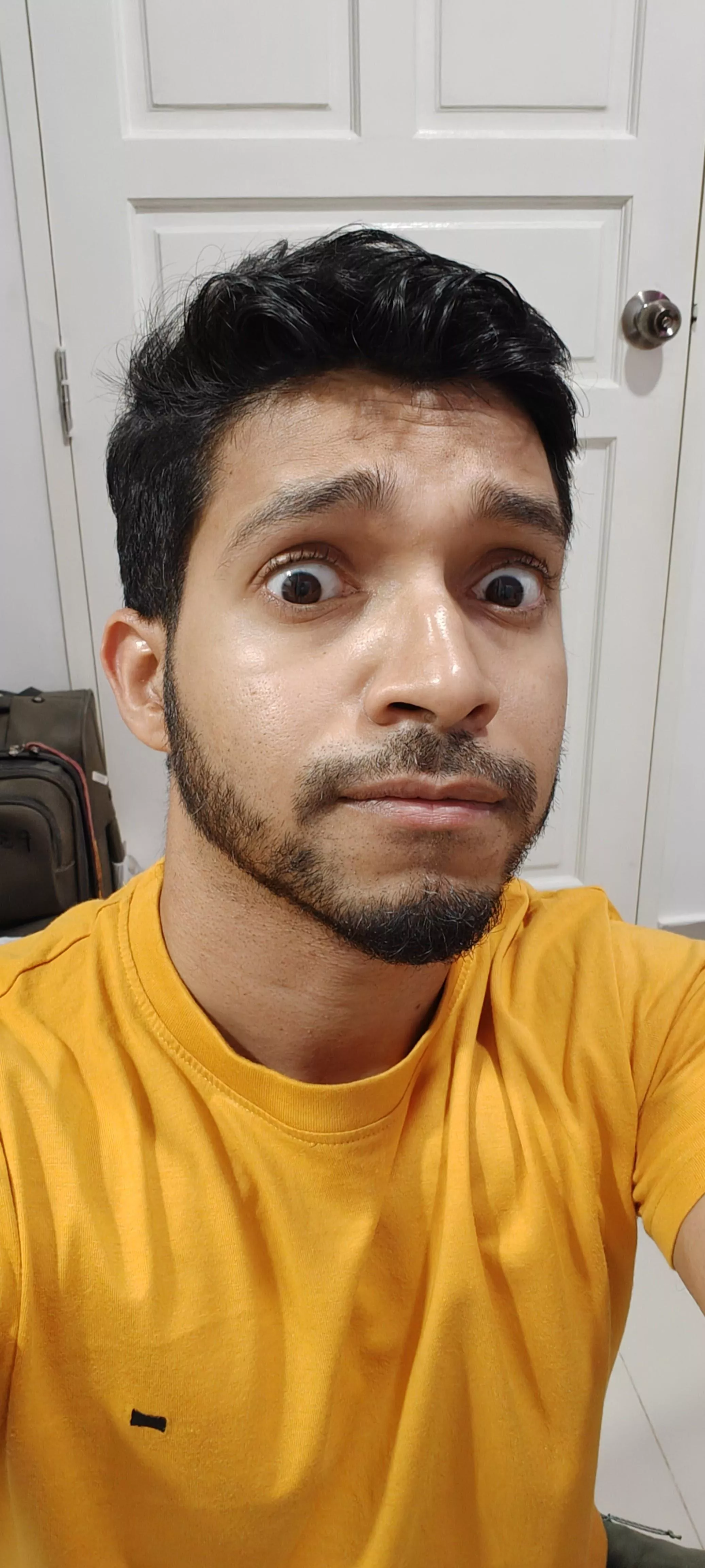 I defeated them years ago ..and they gave me scars I could flaunt.