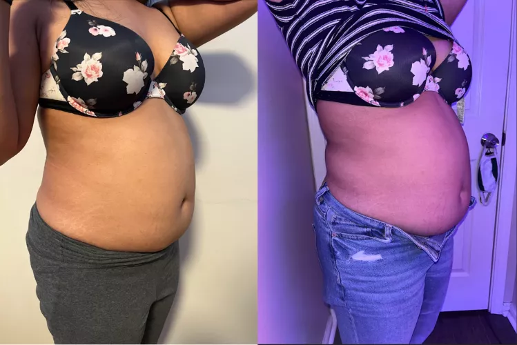 Just starting my journey! 10 Pounds in this picture!