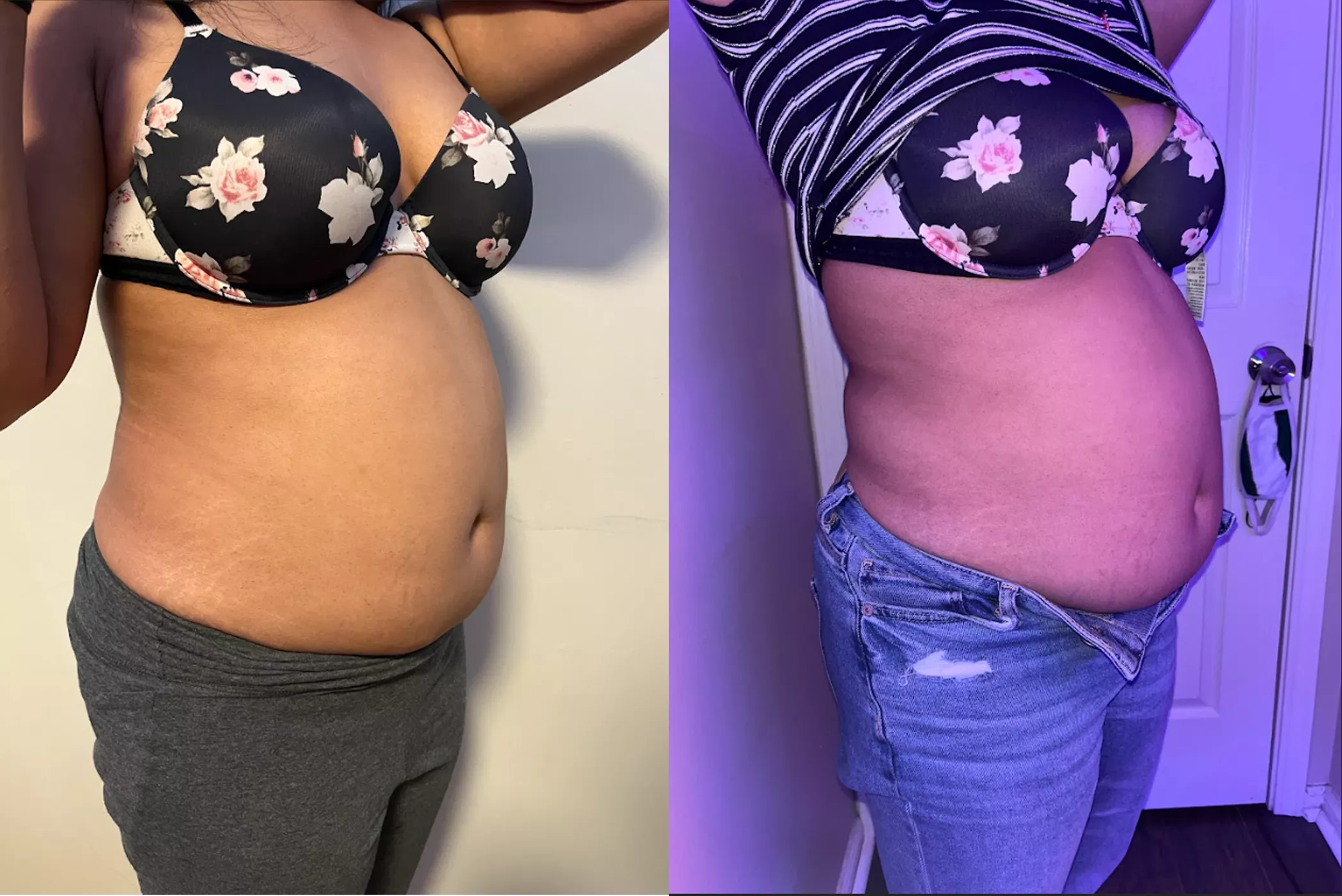 Just starting my journey! 10 Pounds in this picture!