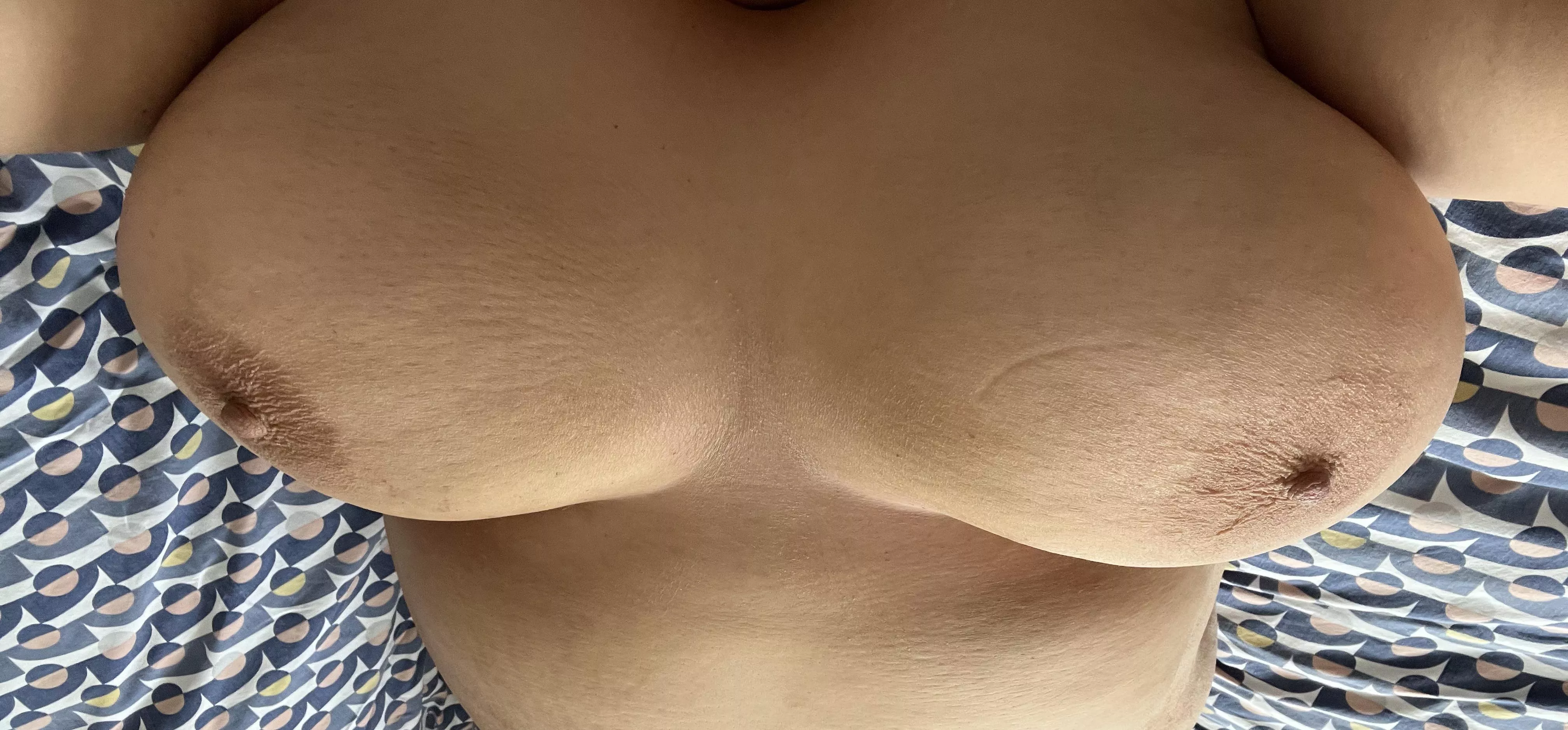 Let me have your feedback