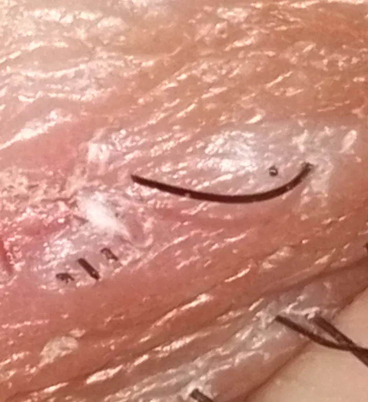 Strange how slow these guys grow. Still itches though.