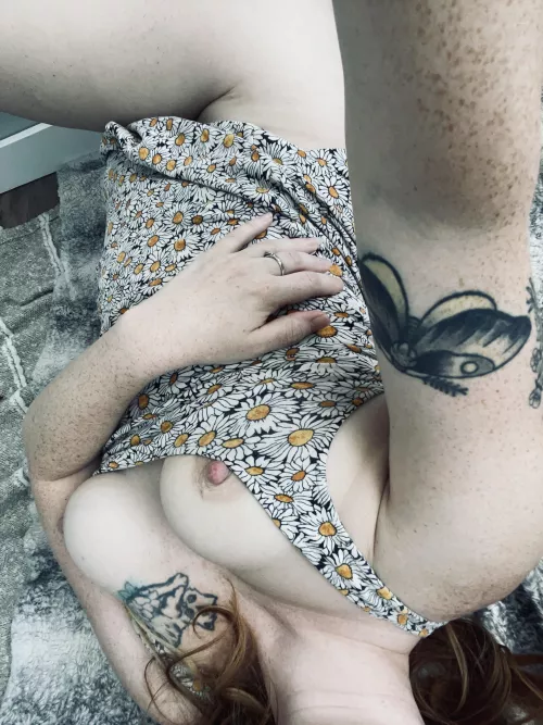 Do you like freckles?