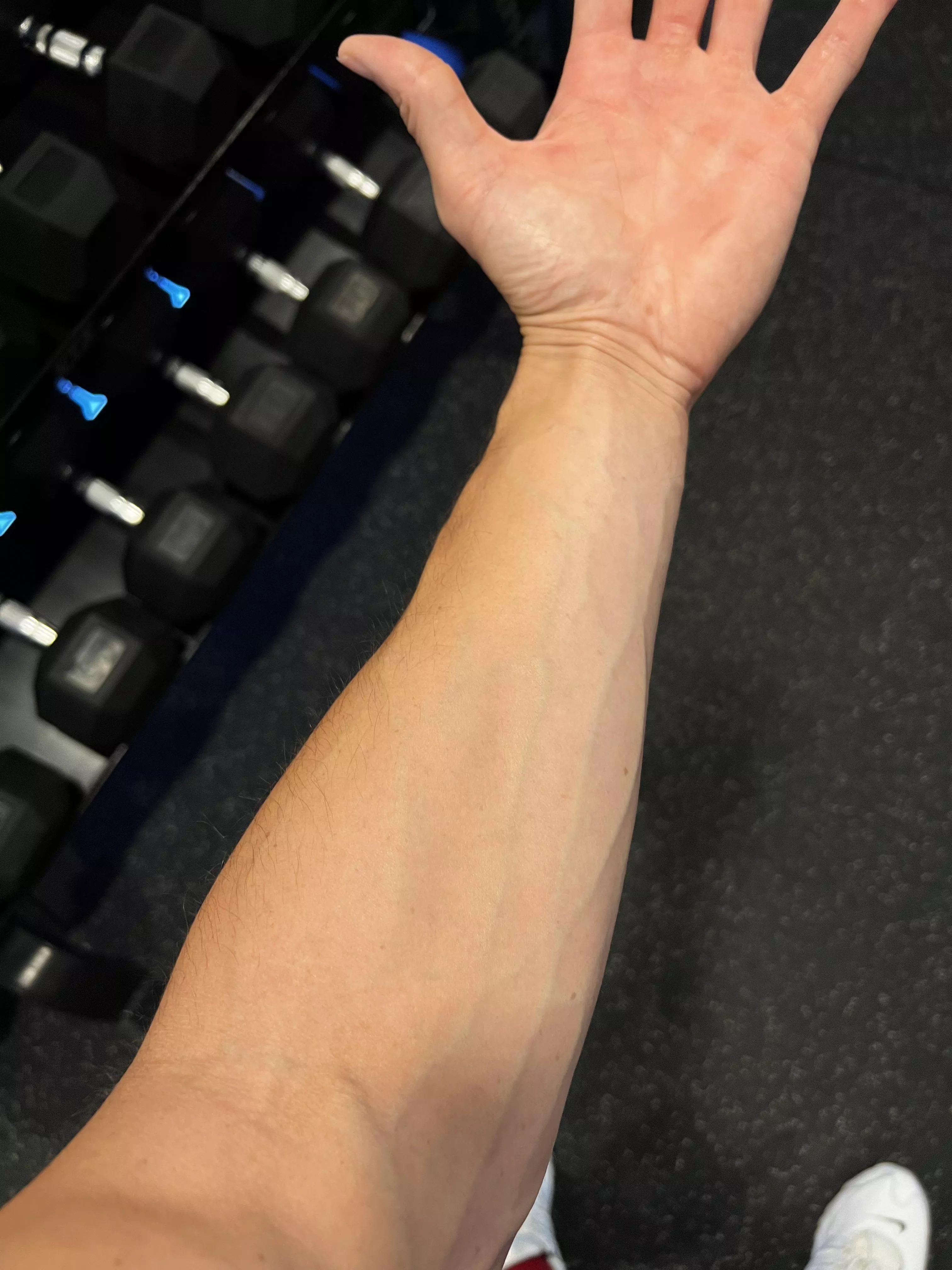 Just a real vascular guy