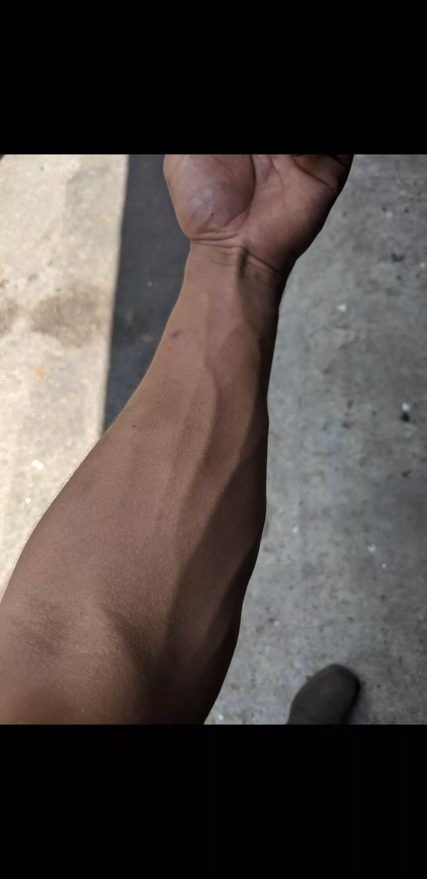 Pre-tattoo, I'll post the updated one soon.