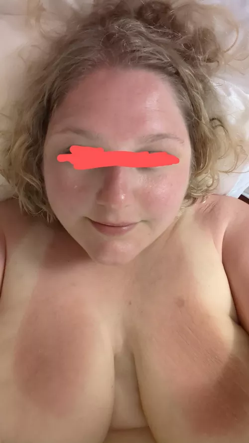Sunburnt bimbo bbw needs cock 🥵