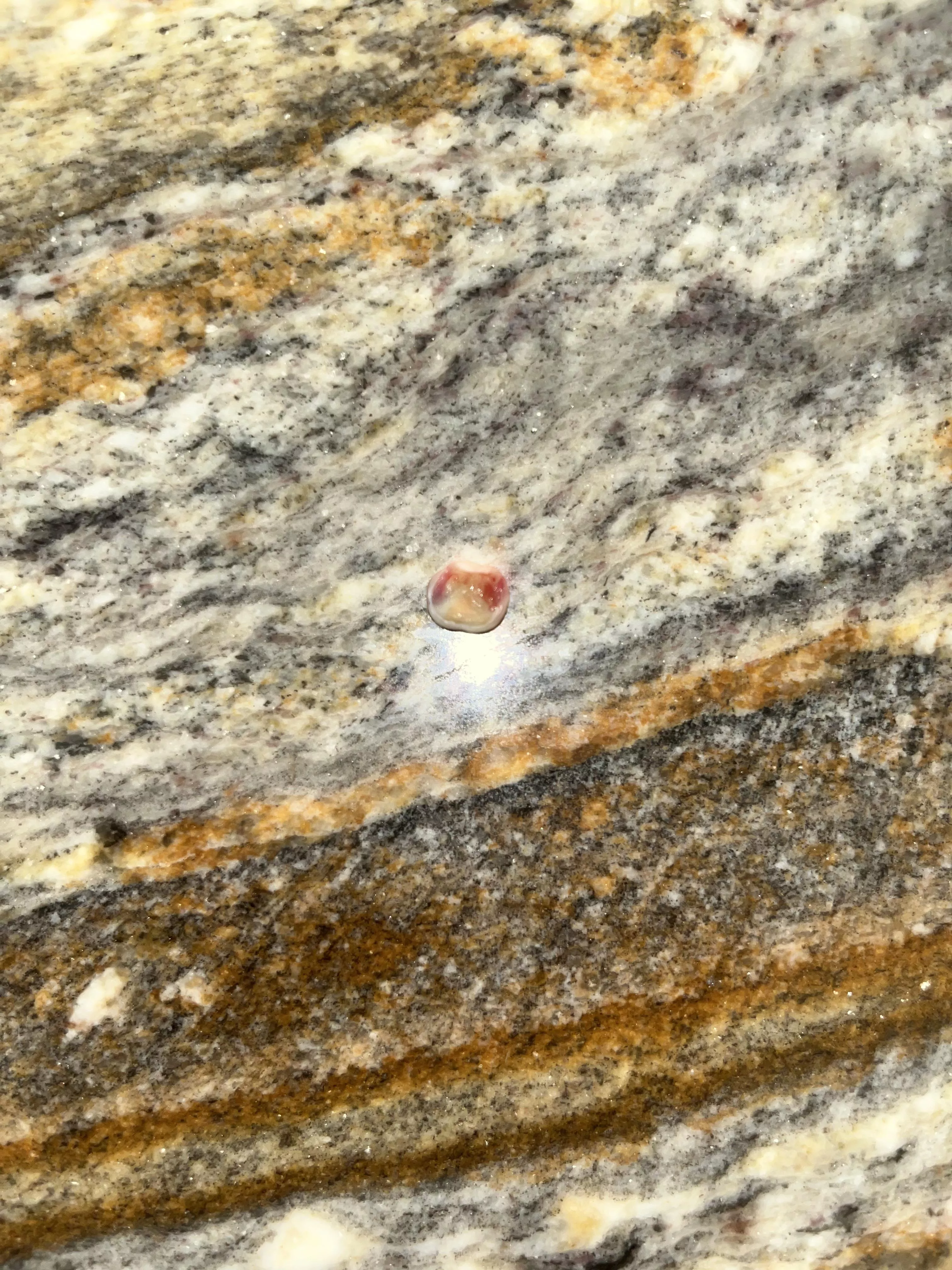 Finally got one of my three remaining baby teeth!