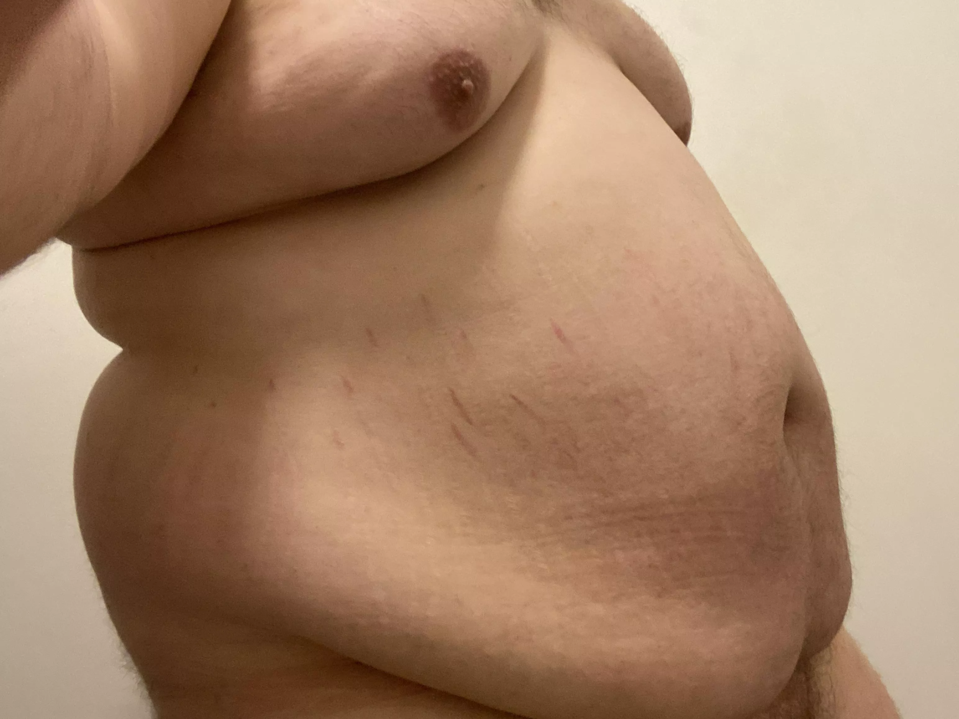 Is this morbidly obese yet? Dm open