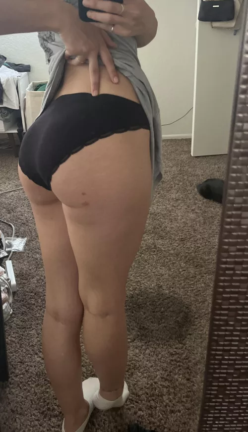 My butt is so sweet mosquitoes even got a taste! [f]