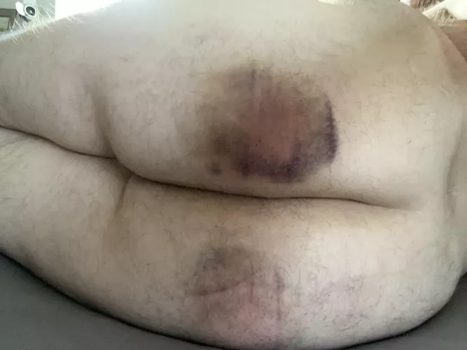 Second Day of Self Spanking