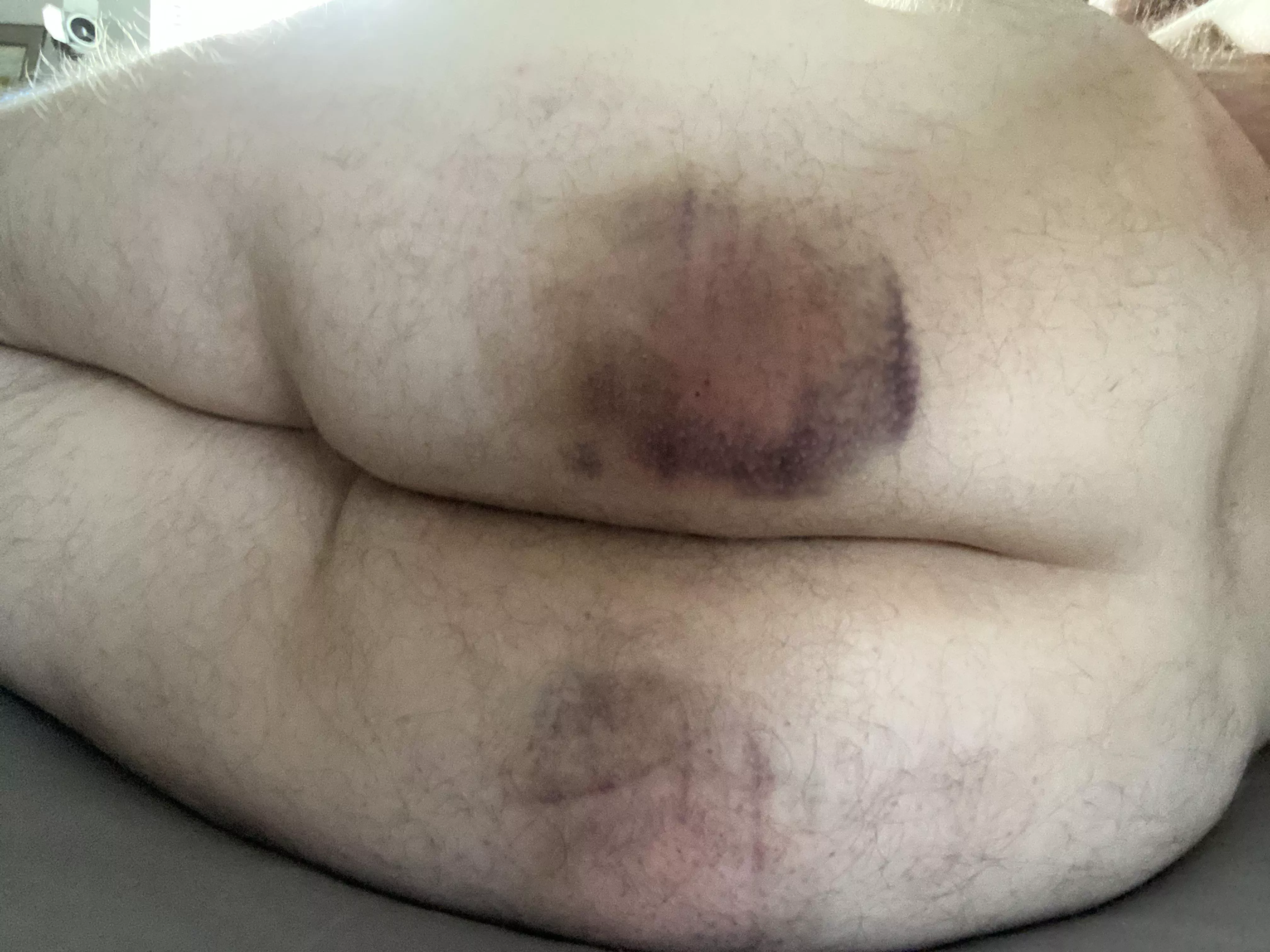 Second Day of Self Spanking