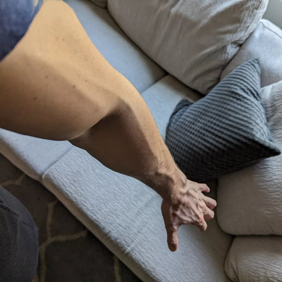 Veins 4 Dayssss 🪱🪱