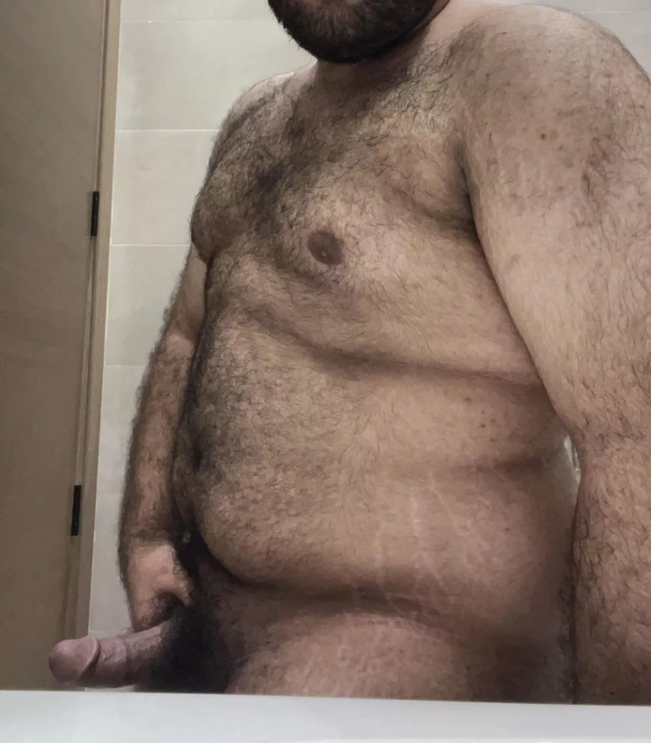 (20) are stretch marks sexy?